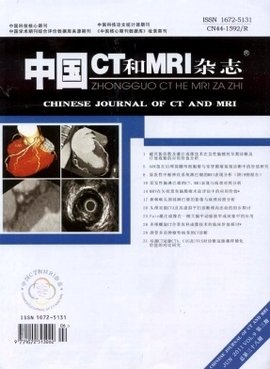 中国CT和MRI 中国CT和MRI